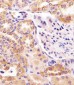 PCCA Antibody (Center)